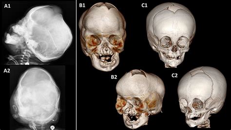 odd shaped skull.